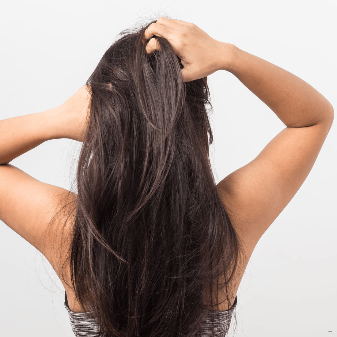 treatments for dry flaky scalps